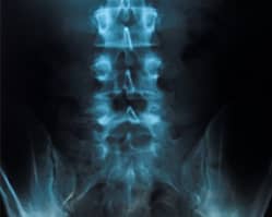 Slider image (6) Dr. GIAN PAOLO TASSI | Neurosurgery Specialist